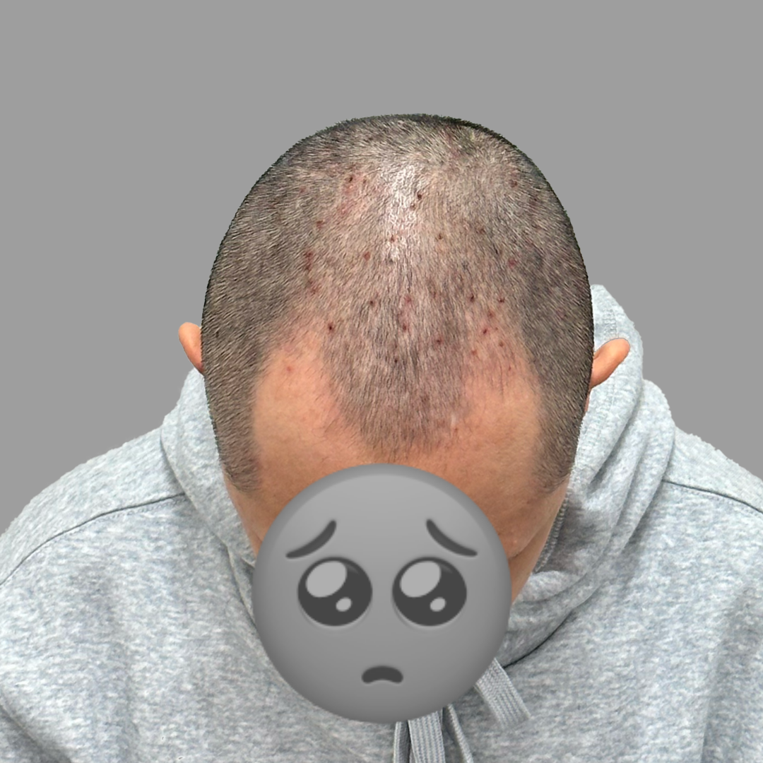 before-dotink-ver001