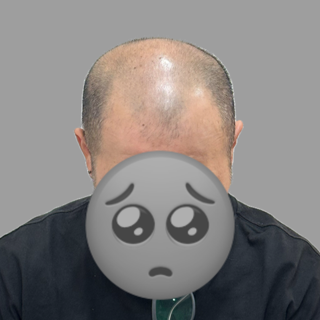 before-dotink-ver002