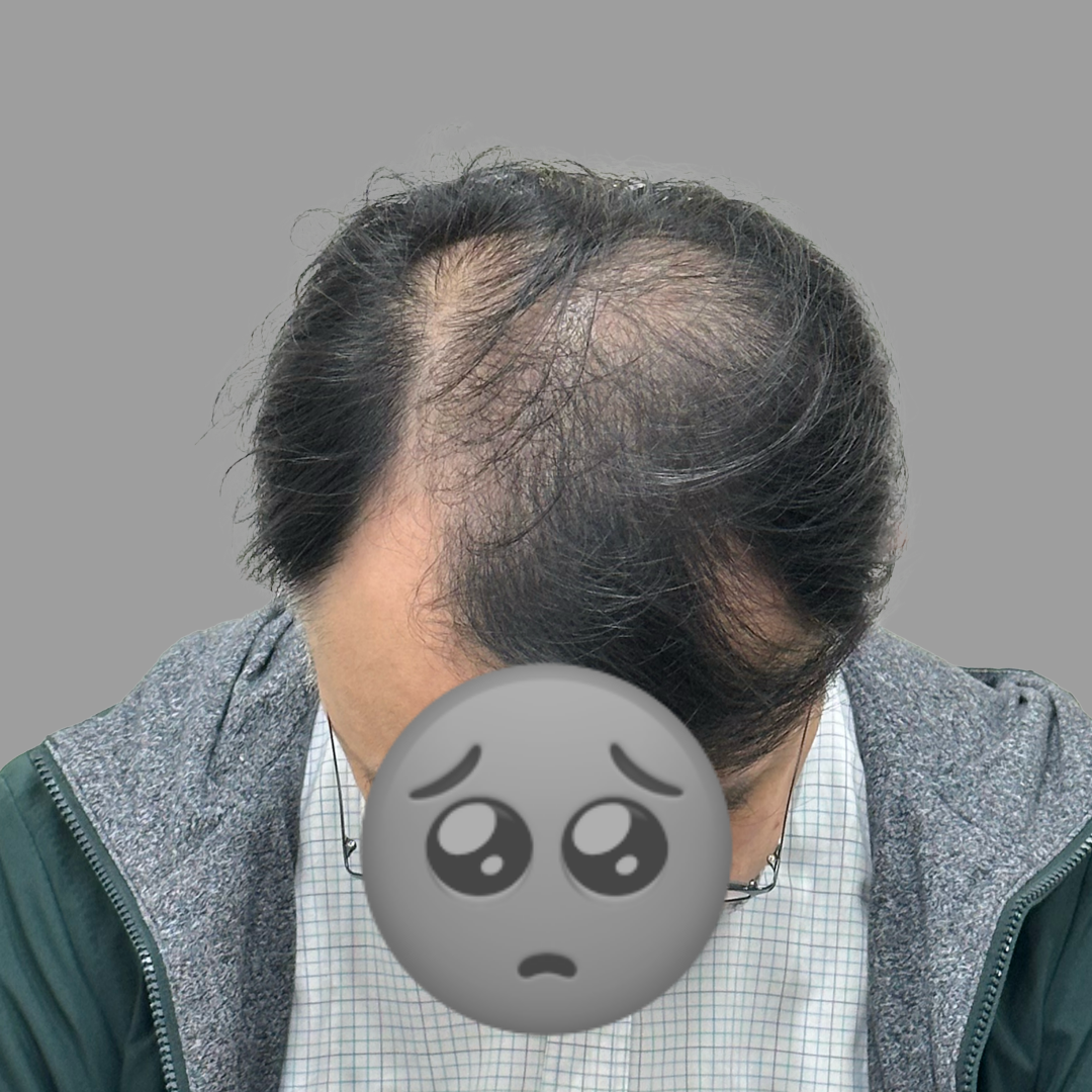 before-dotink-ver003