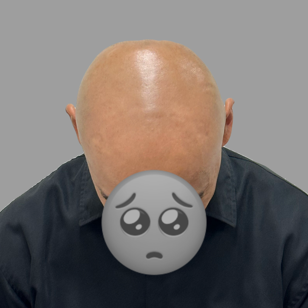 before-dotink-ver004