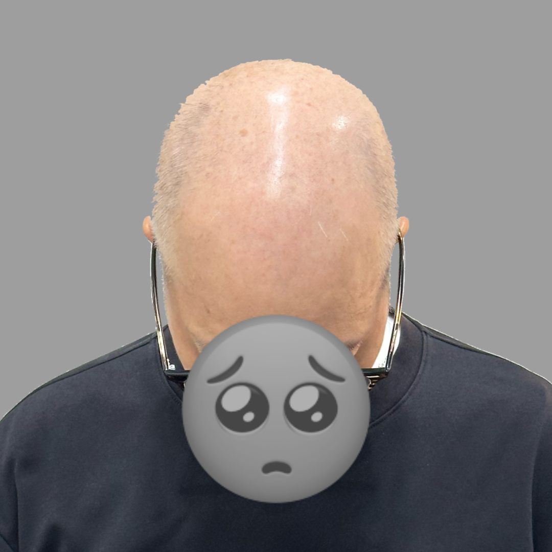 before-dotink-ver005