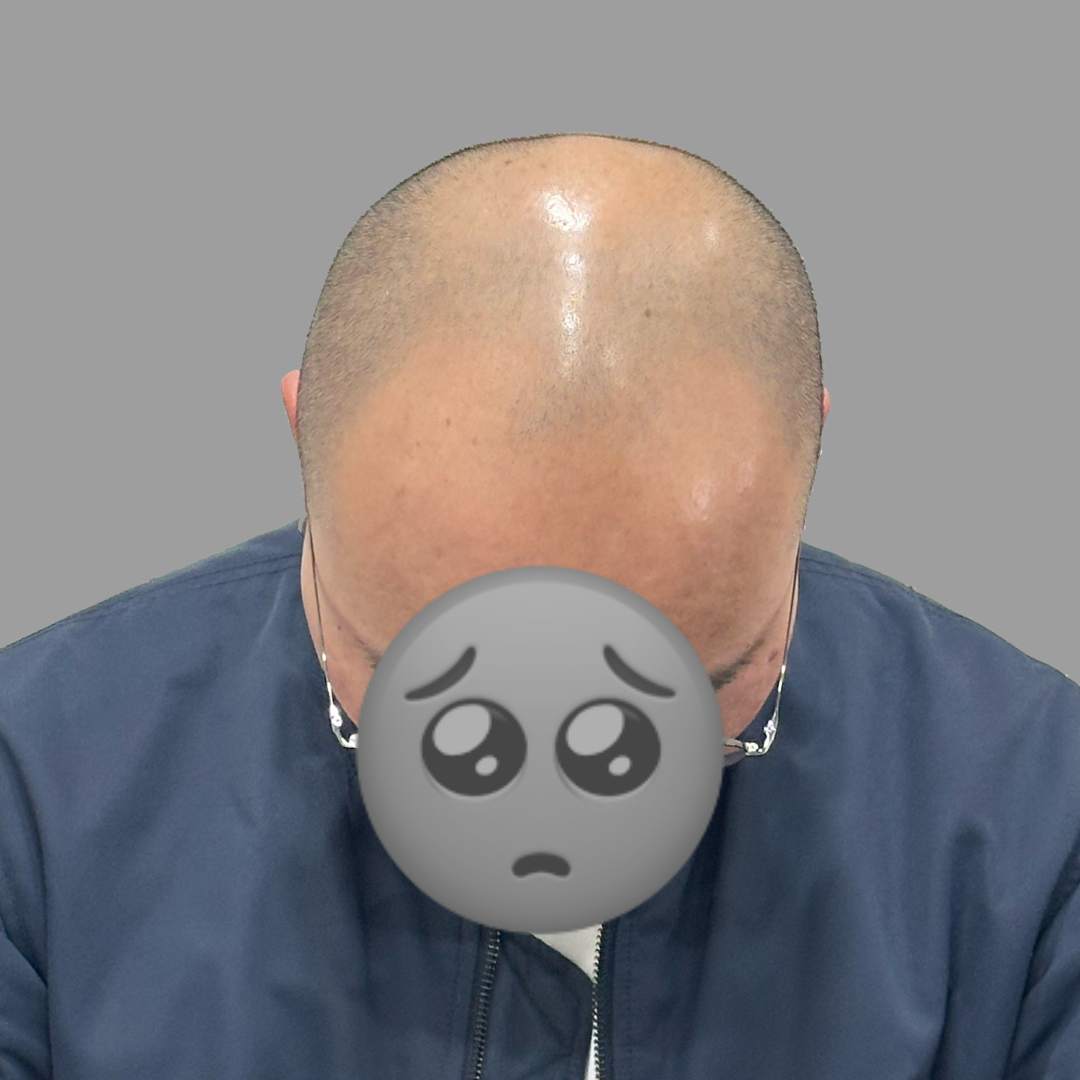 before-dotink-ver006