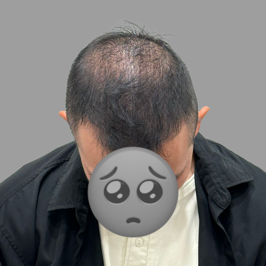 before-dotink-ver007