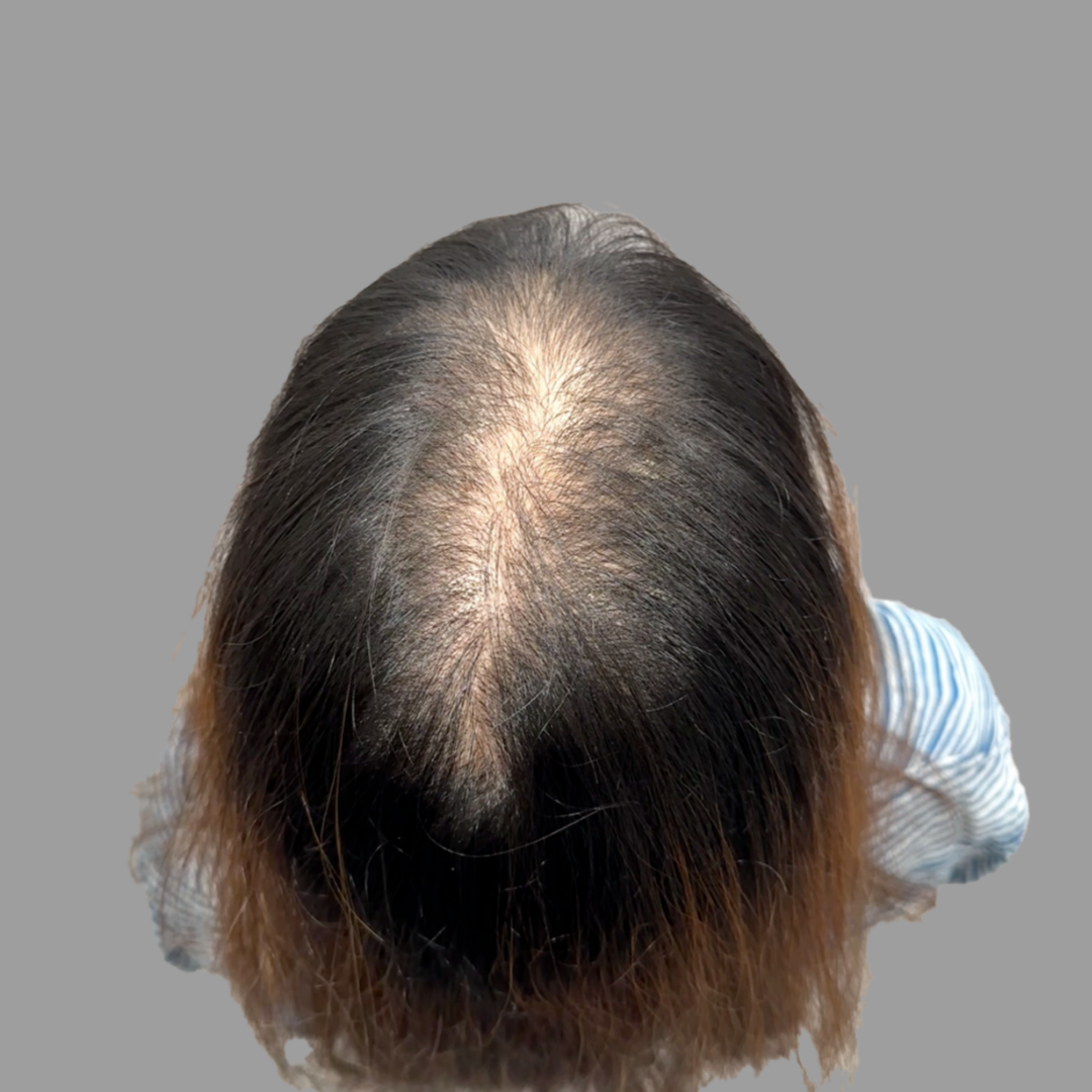 before-dotink-ver008